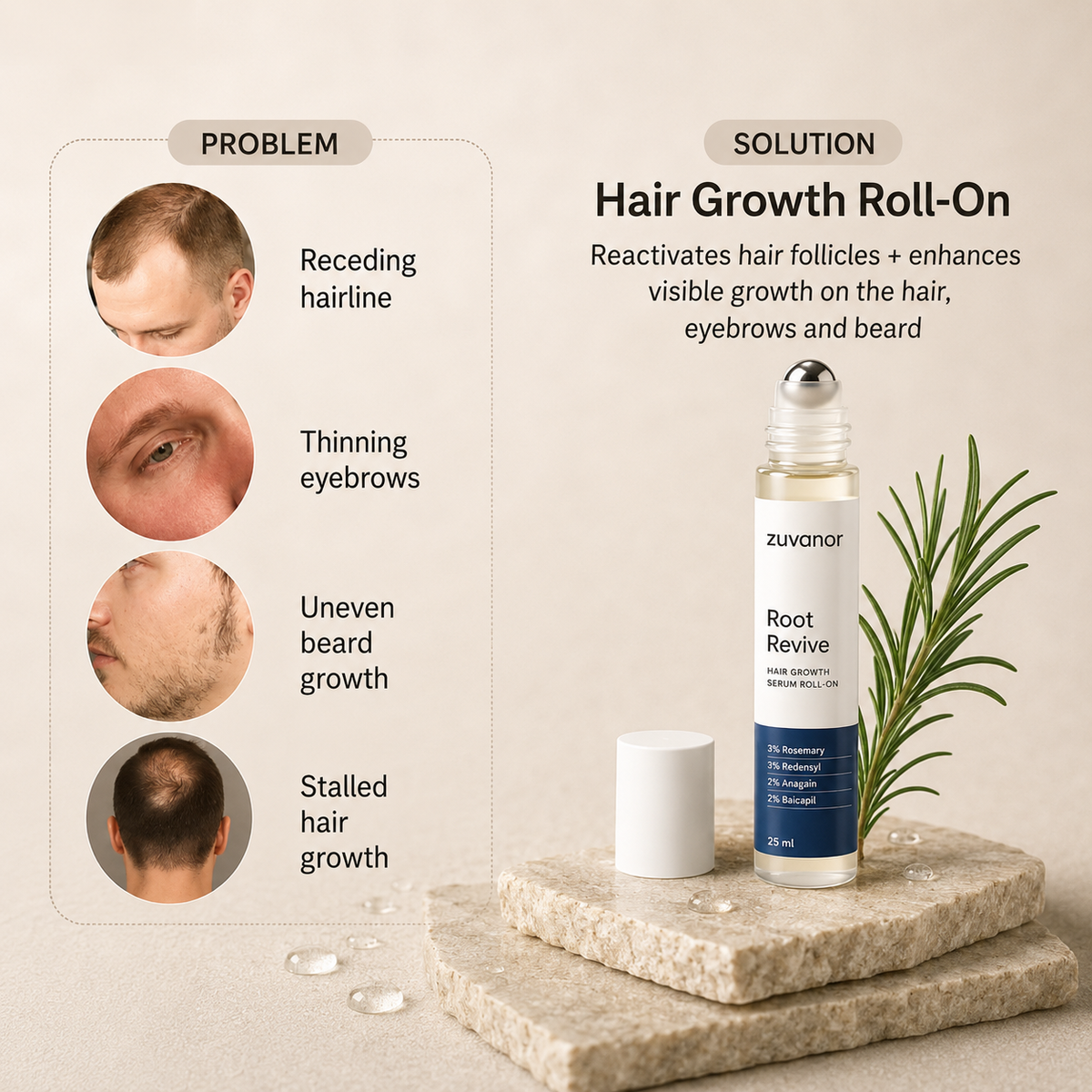 Root Revive Roller